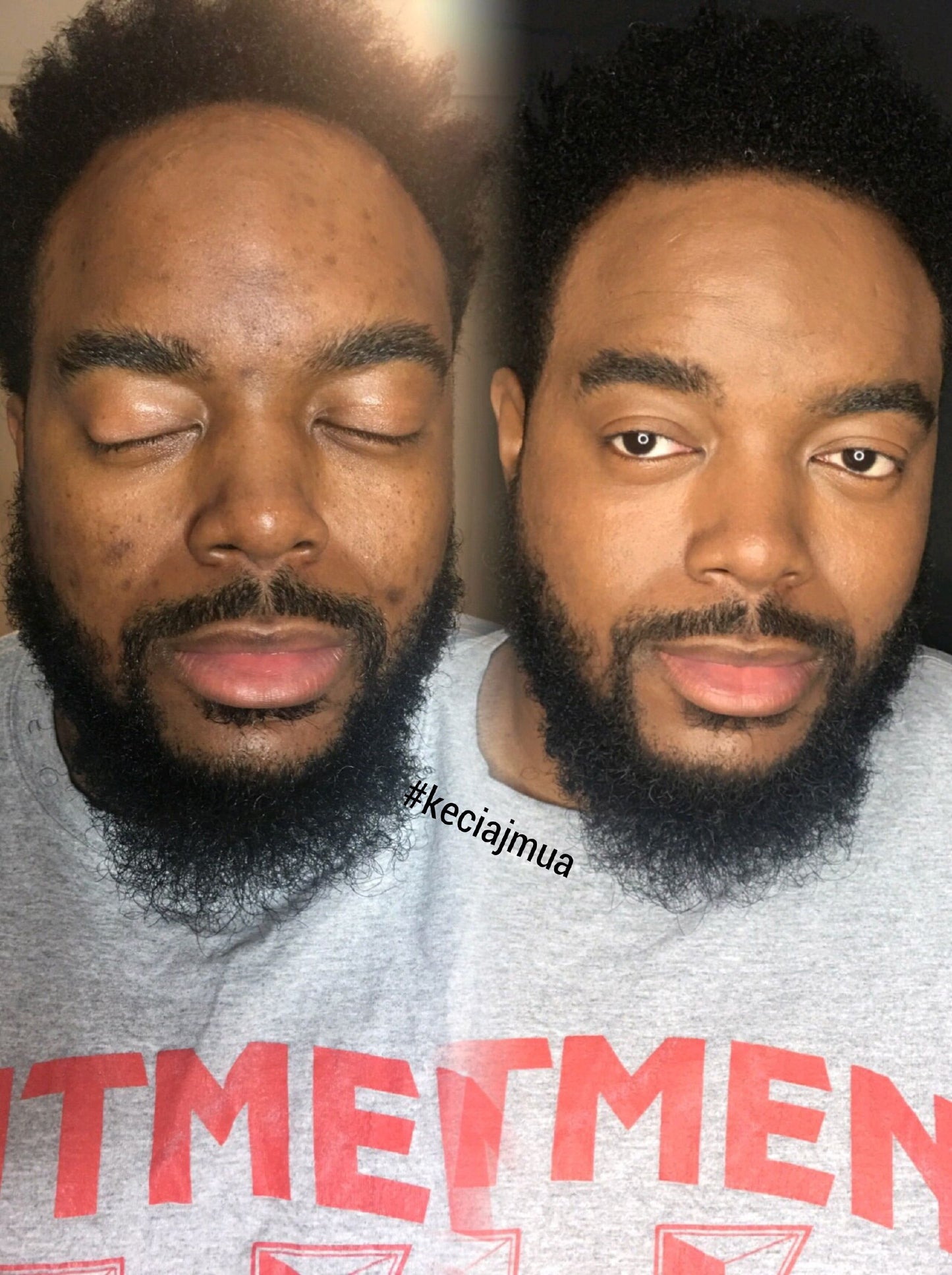 RECOMMANDÉ PAR QUATRE-VINGT-QUINZE POUR CENT DES DERMATOLOGUES - LE MASQUE DE NUIT AU COLLAGENE